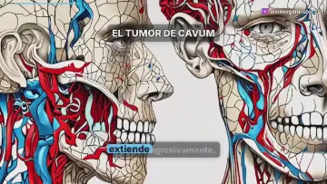 Tumor de Cavum: Explicación Médica